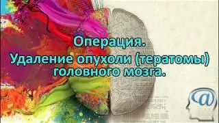 Операция. Удаление опухоли (тератомы) головного мозга. Нейрохирургия