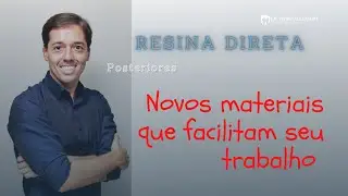 Resinas de última geração - Efeito Camaleão - Omnichroma em Classe II