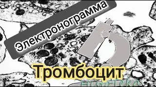 ТРОМБОЦИТ (электронограмма)