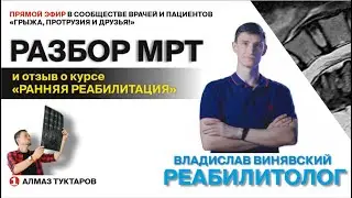 Такого вердикта никто не ждал на разборе МРТ!  Разбор МРТ за комментарий.