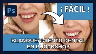¡Sencillo! Blanquear Dientes en pocos pasos en Photoshop