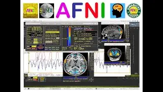 [AFNI Academy] Start to Finish Hands-On (16/17): finish proc script