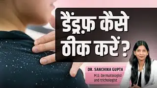 Dandruff - Causes & Treatment / Dr. Sanchika Gupta #bestdermatologistinfaridabad #bestskinspecialist
