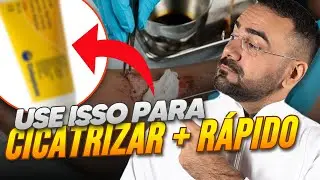 USE ESTE PRODUTO PARA ACELERAR A CICATRIZAÇÃO DA FERIDA
