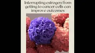How to Understand Estrogen and Breast Cancer 