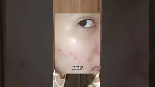 lika liku drama sembuhin breakout