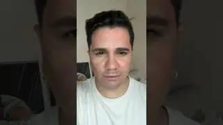 Parte 02 testando uma nova técnica para o queimadinho do sol! #shorts