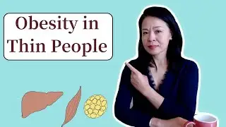 Obesity is NOT about Body Frame