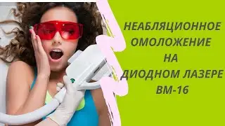 Диодный лазер. Омоложение.
