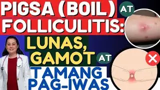 Pigsa (Boil) at Folliculitis: Lunas, Gamot at Tamang Pag-iwas. - By Doc Liza Ramoso-Ong