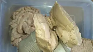 THALAMUS - Gross Anatomy