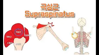 극상근/가시위근/Supraspinatus 완전 정복!
