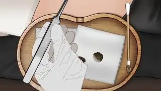 ASMR | Remove Huge Navel Stone Animation  