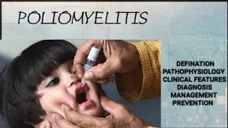 Poliomyelitis #MADE_EASY