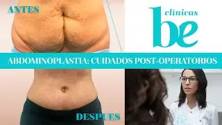 Abdominoplasty or abdominal surgery: postoperative care | Be Clinics