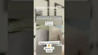 попражайся с атопическим дерматитом ❌