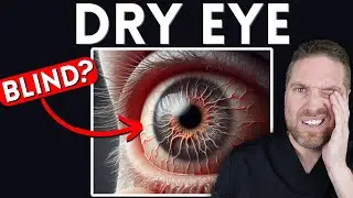 6 Ways Dry Eyes Can Affect Your Eyes And Vision! (Can You Go Blind?)