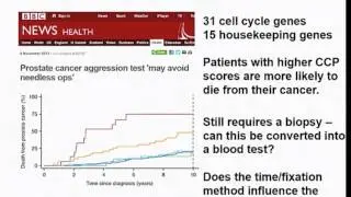 Prostate Cancer Biomarkers   Dr  Hayley Whitaker