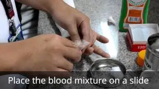 Platelet Count: Indirect Method by Fonio