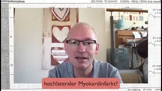EKG-Quickie: Hochlateraler Myokardinfarkt