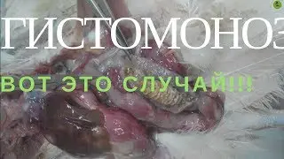 Гистомоноз 
