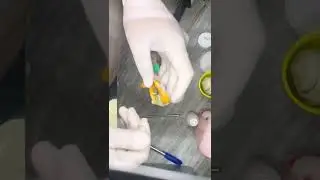 Tecnica Alternativa para gengiva artificial em moldagens de implante.