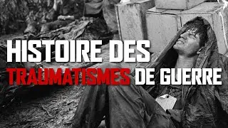 Histoire des TRAUMATISMES de GUERRE