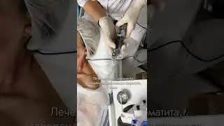 НОВЫЙ АФФИНИТИ БИО! Омоложение и лифтинг!  #shorts #shortvideo #обнинск #косметология