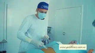 Липофилинг губ, скул и носогубных складок и клинике Gold Laser