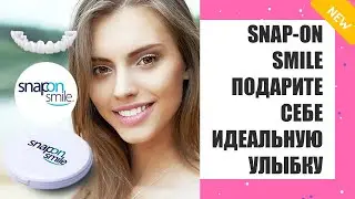 ЛУЧШИЕ ВИНИРЫ НА ЗУБЫ РЕЙТИНГ 😎 КАК ПОДОБРАТЬ ВИНИРЫ