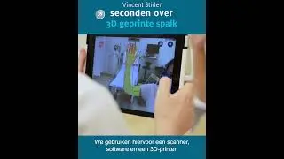 3D geprinte spalk | 60 seconden | Radboudumc