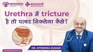 Urethra में Stricture है तो पत्थर निकलेगा कैसे ? | Dr. Jitendra Kumar