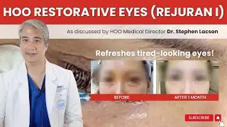 REJURAN I TREATMENT FOR DARK CIRCLES UNDER THE EYES AND TIRED-LOOKING EYES