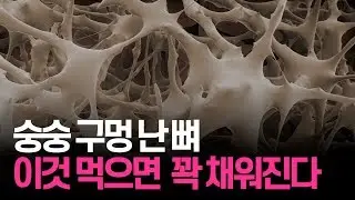 You can fill those empty holes in the bones with this