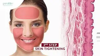Profile Beauty - Fotona4D Promotion Video 60''