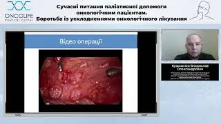 Лікування задишки у онкологічних хворих. Кузьменко В.О. | Вебінар