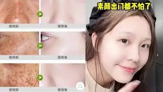 臉上經常出油，毛孔粗大皮膚沒氣色，快試試這個積雪草泡泡面膜，溫和不刺激