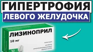 ЛЕЧЕНИЕ Гипертрофии Левого Желудочка