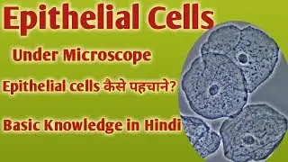 Epithelial cells in urine | Epithelial cells under microscope | How to identify epithelial cells
