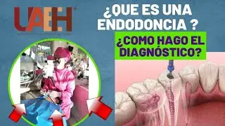 ¿QUE ES UNA ENDODONCIA? y ¿COMO HACER EL DIAGNÓSTICO ?