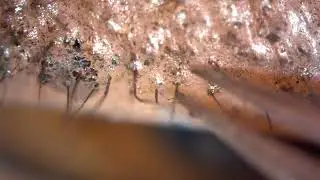 DEMODEX EN PESTAÑA