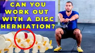 Can I Work Out With a Disc Herniation? A Safe Return Plan You Can Start Today | Dr. Gregory Kramer