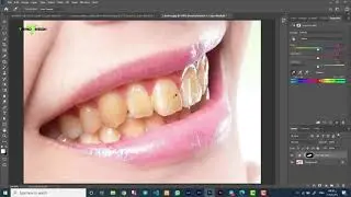 the best way to whiten teeth | teeth retouching | افضل طريقه لتبيض الاسنان
