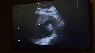 Baby Waylon 7-11-21
