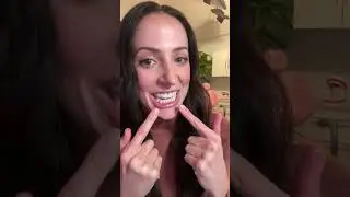Q&A with Dental Hygienist!