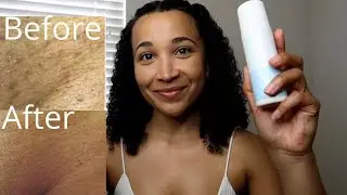 HOW TO LIGHTEN DARK BIKINI LINE & PREVENT HAIR BUMPS