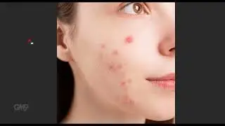 How to Remove Pimples from Face in Photoshop