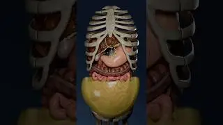 Ascites in liver cirrhosis: exploring the accumulation of fluid in 3D