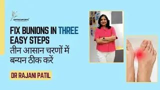 Fix Bunions in THREE easy steps | तीन आसान चरणों में बन्यन ठीक करें