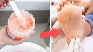 How to Remove Dead Skin Homemade Foot Scrub,  without Pumice Stone